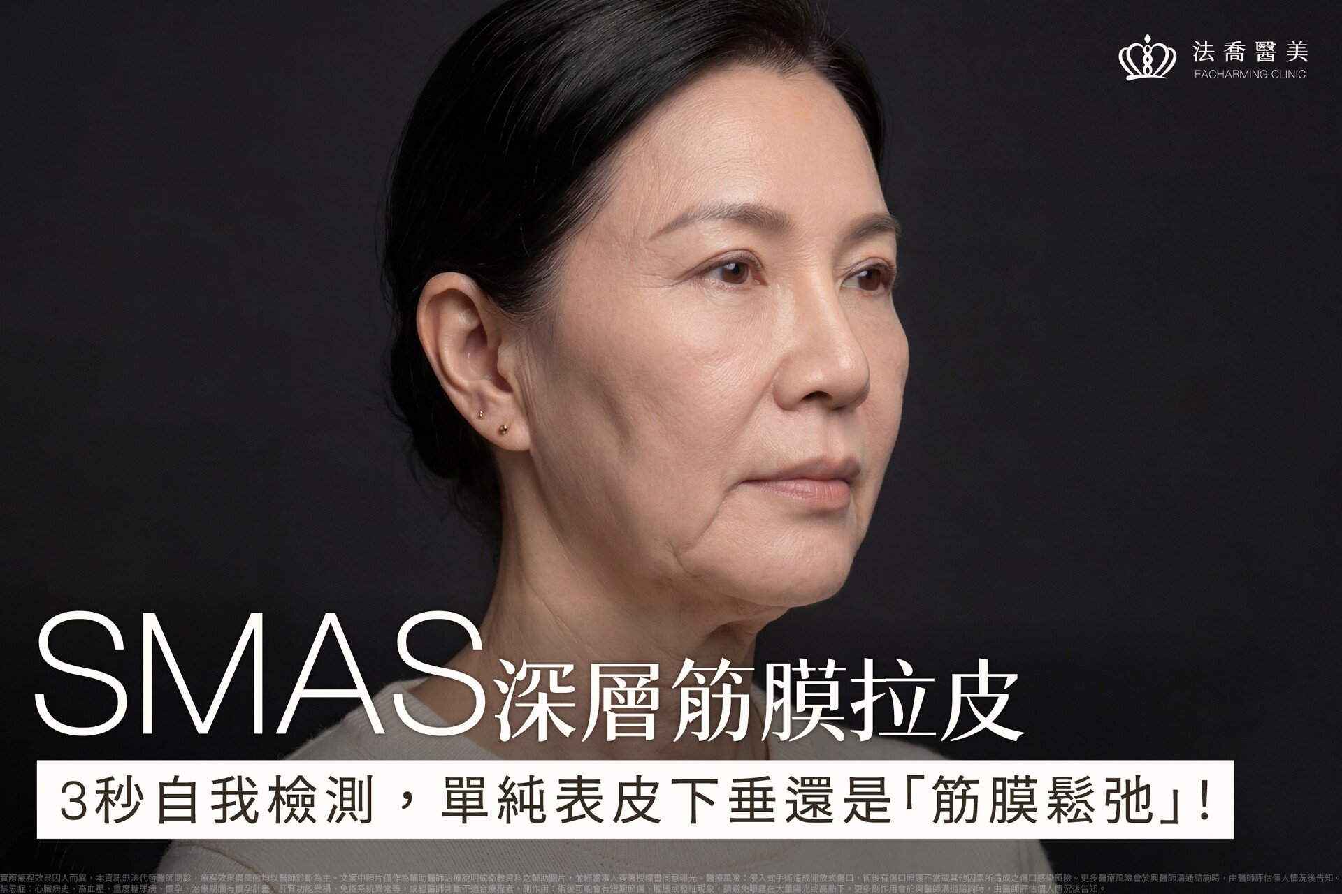 SMAS深層筋膜拉皮