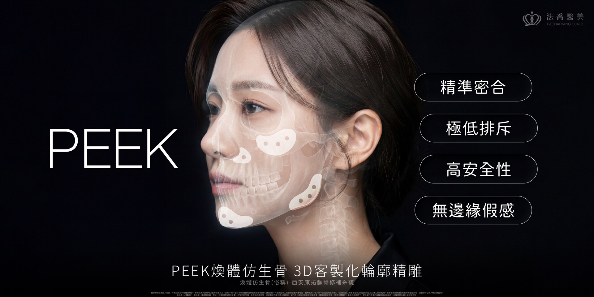 【PEEK煥體仿生骨 3D客製化輪廓精雕】揮別無效填補,從深層骨相重塑專屬你的高級感!