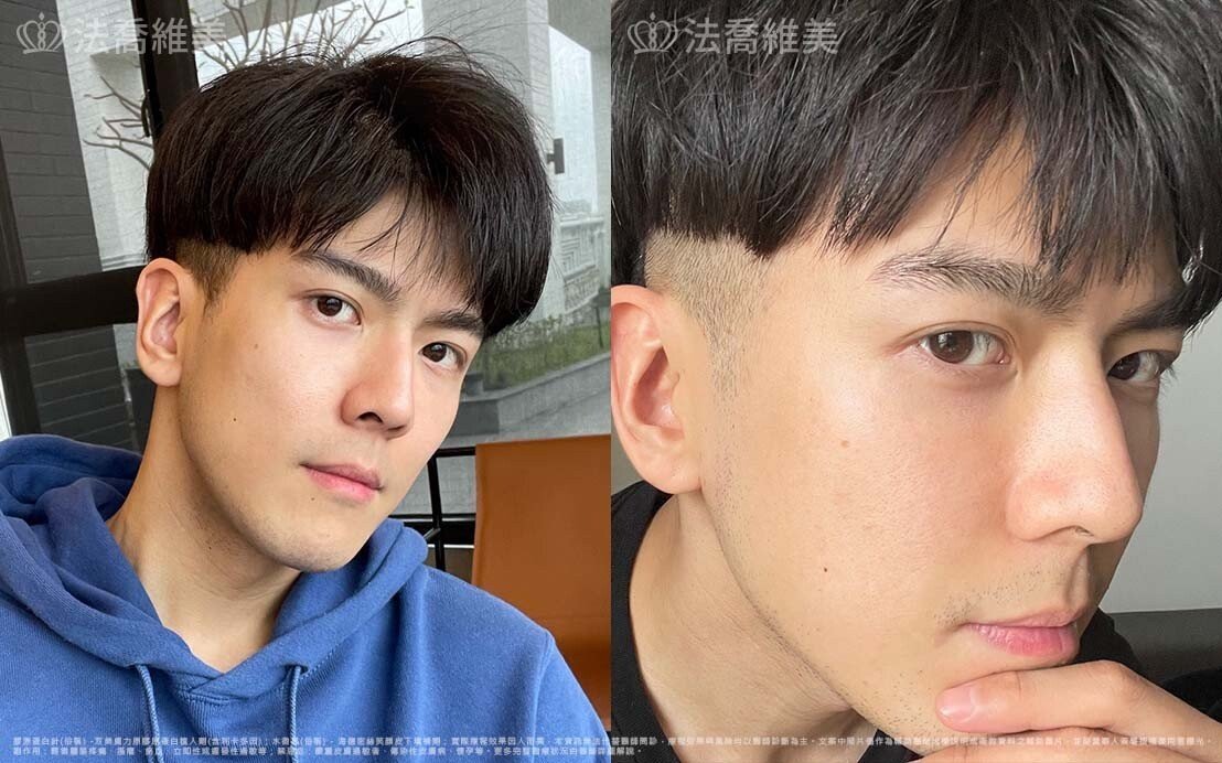 《周墨》擺脫黑眼圈 擺脫疲憊感