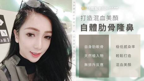 隆鼻案例 美伊 自體肋骨隆鼻 縮鼻翼 鼻截骨 法喬維美醫美診所 台北 台中 高雄