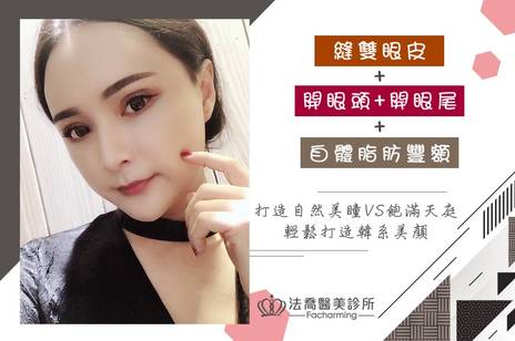 眼部案例 林蕭 縫雙眼皮 開眼頭 開眼尾 法喬維美醫美診所 台北 台中 高雄