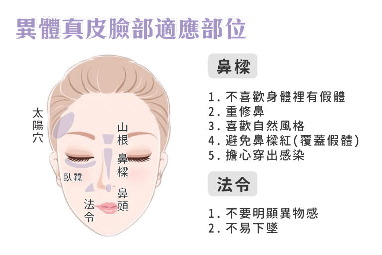 異體真皮隆鼻