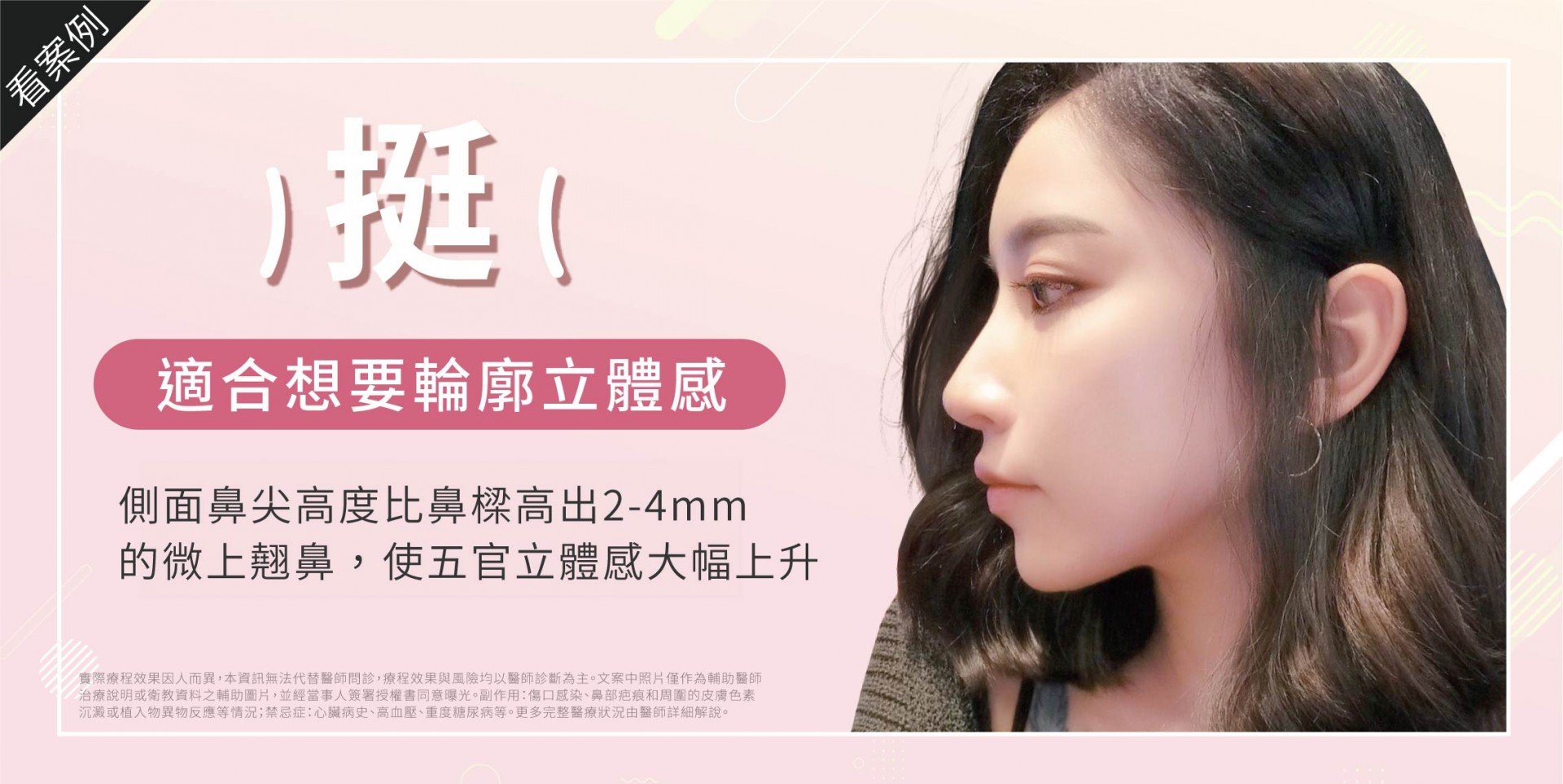 輪廓立體感挺鼻