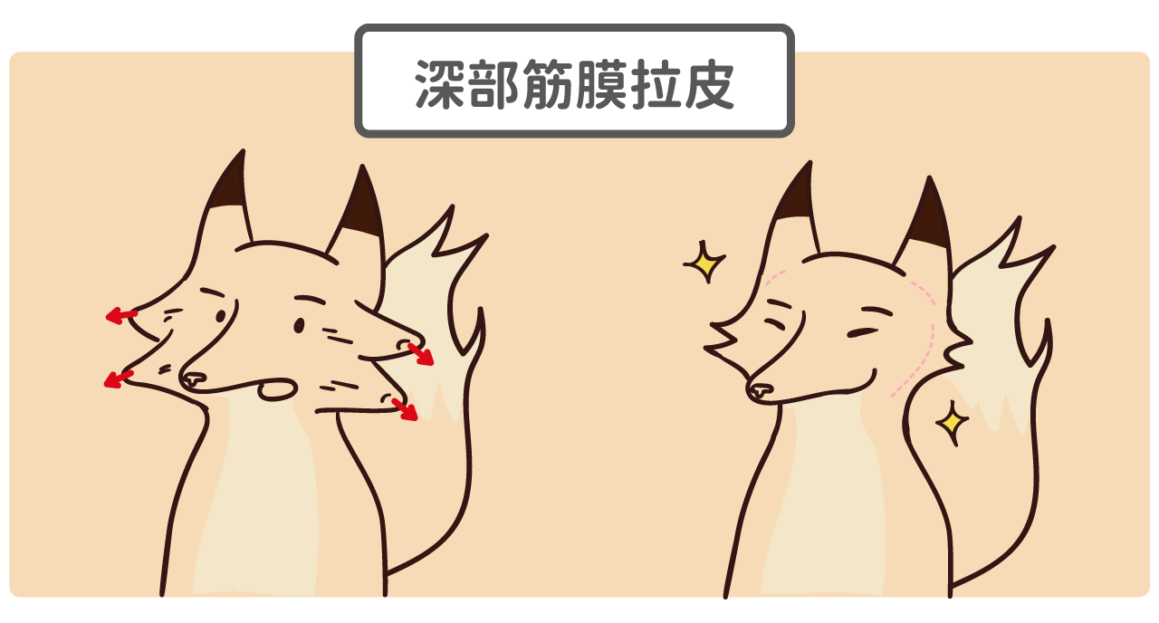 臉部拉皮插圖