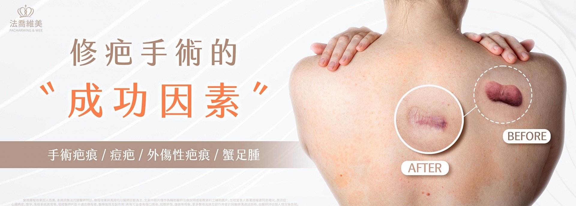 修疤手術