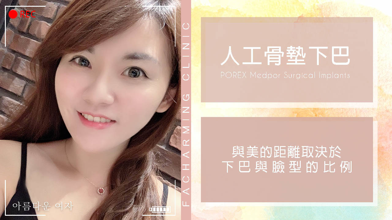 法喬醫美診所-3D列印人工骨客製化下巴