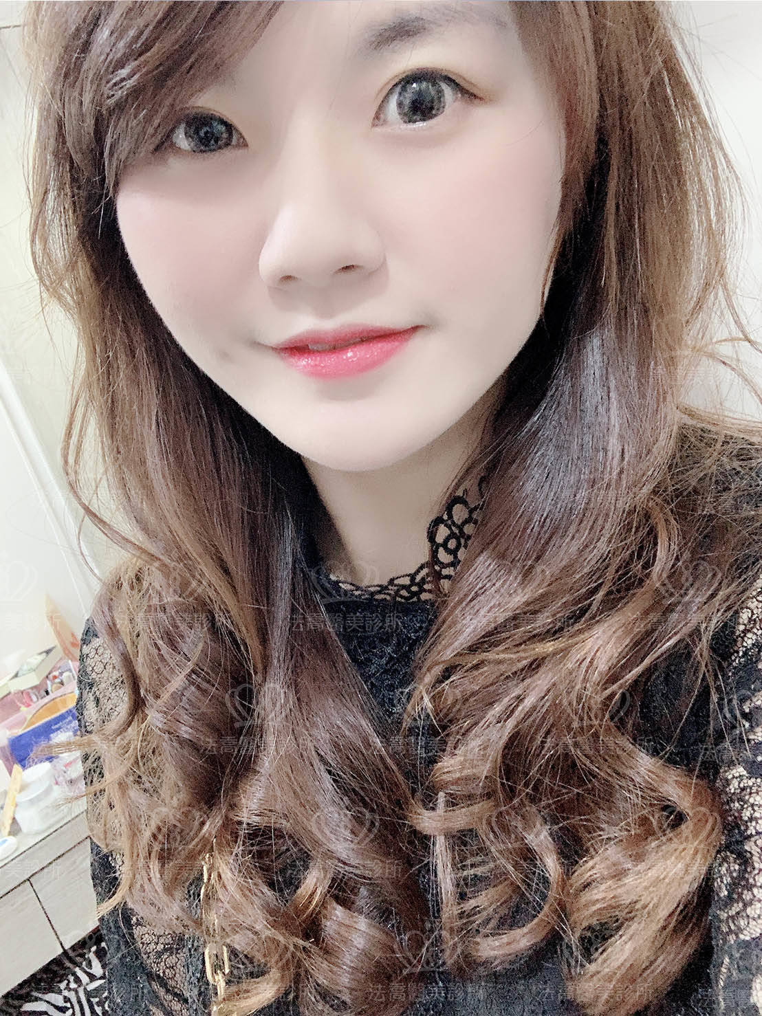 法喬醫美人工骨下巴術後2M