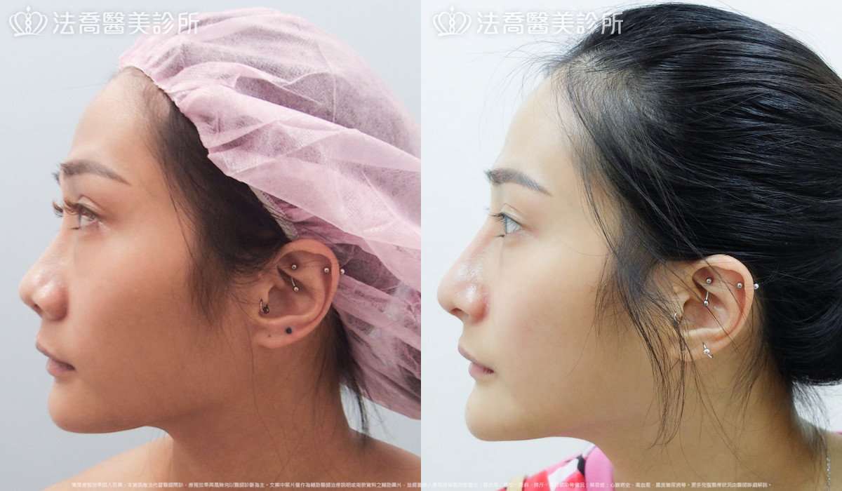 法喬醫美診所 邱浚彥醫師