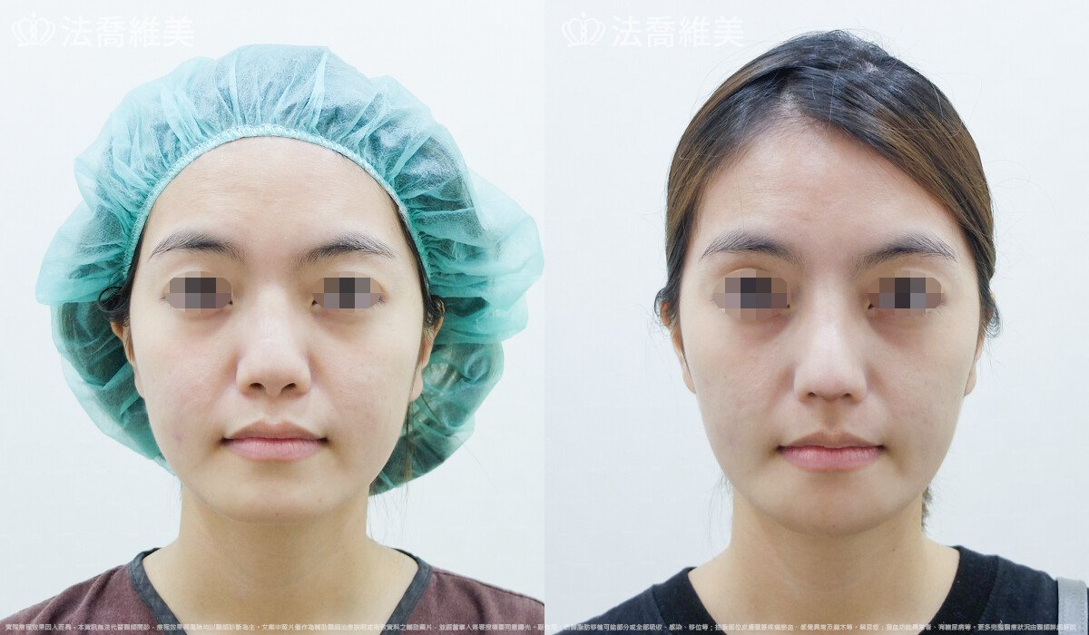 法喬維美醫美診所
