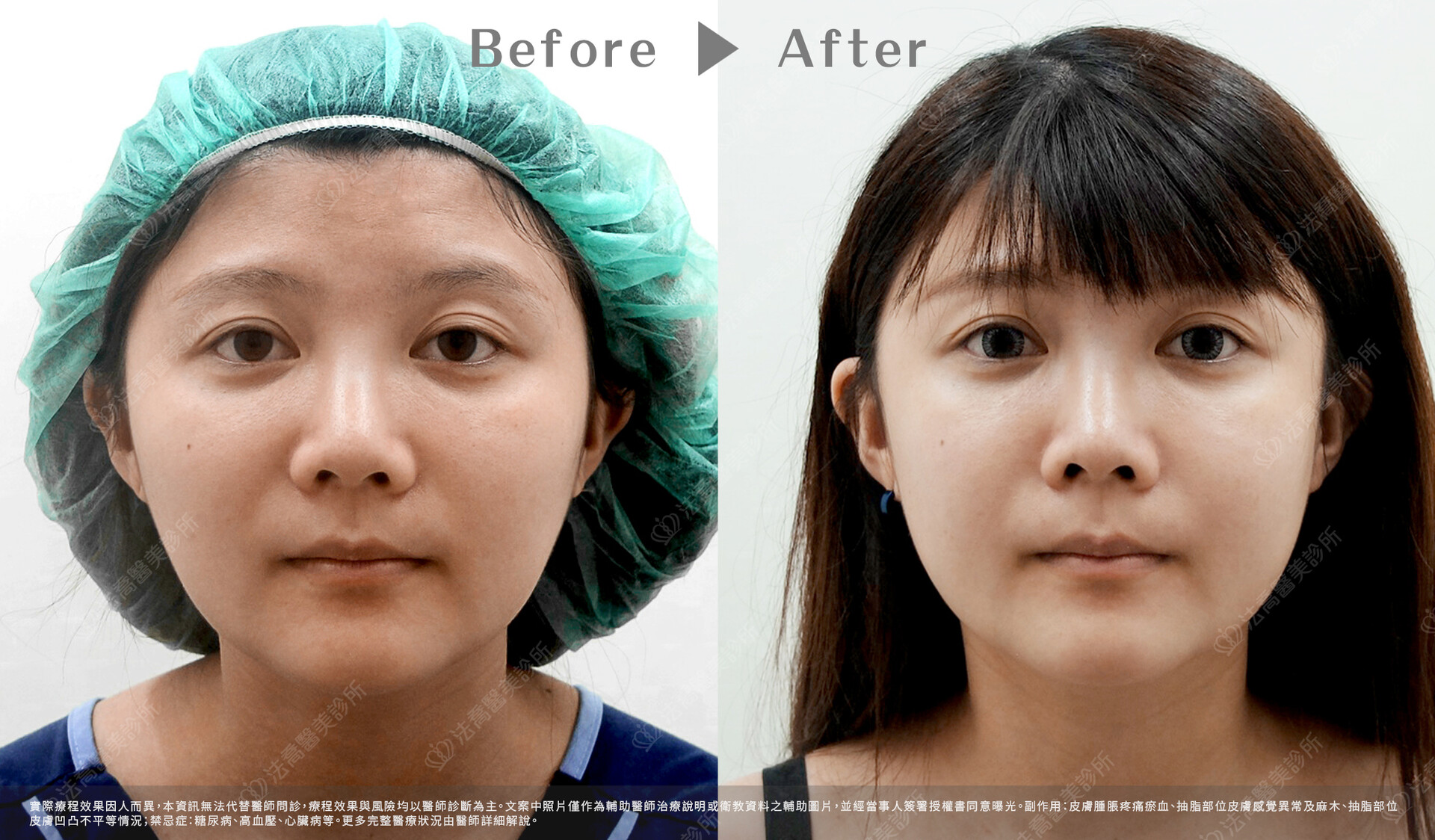 法喬醫美診所 邱浚彥醫師