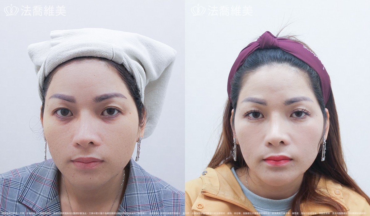 法喬維美