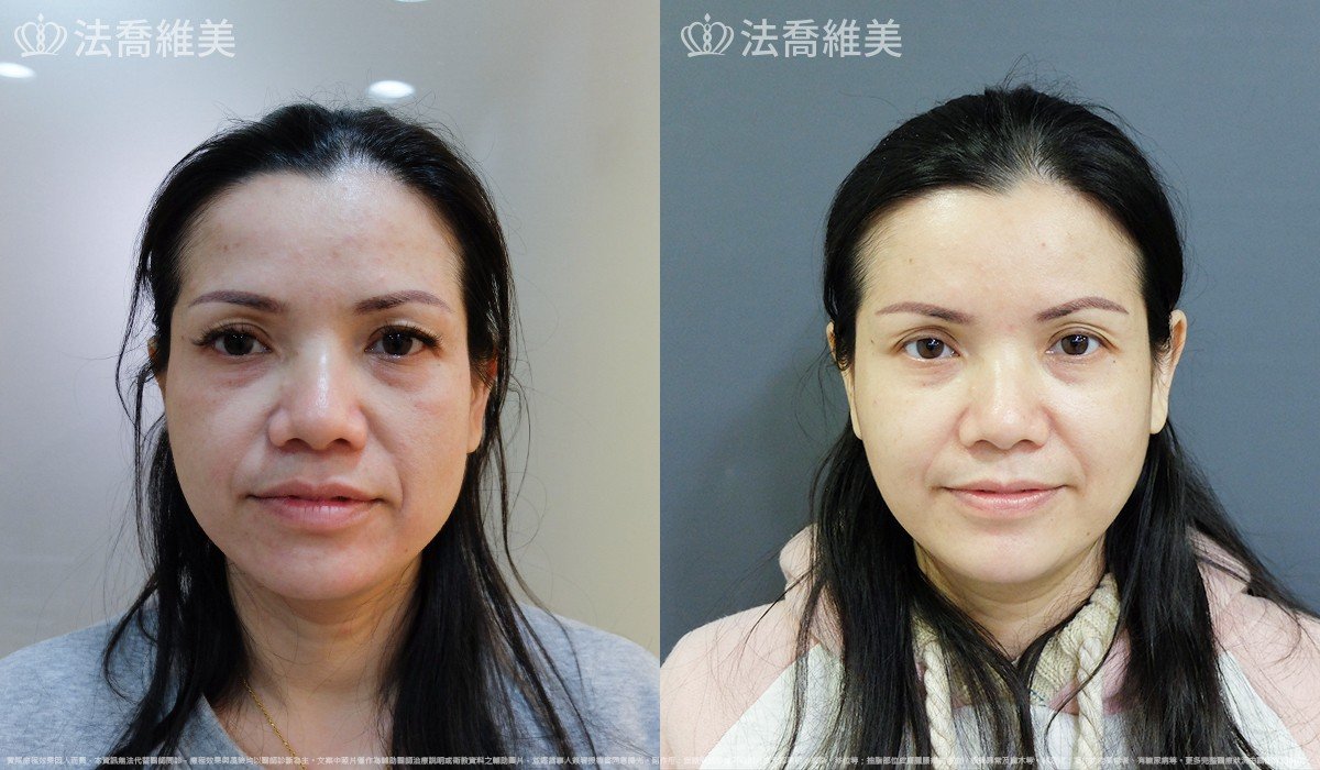 法喬維美