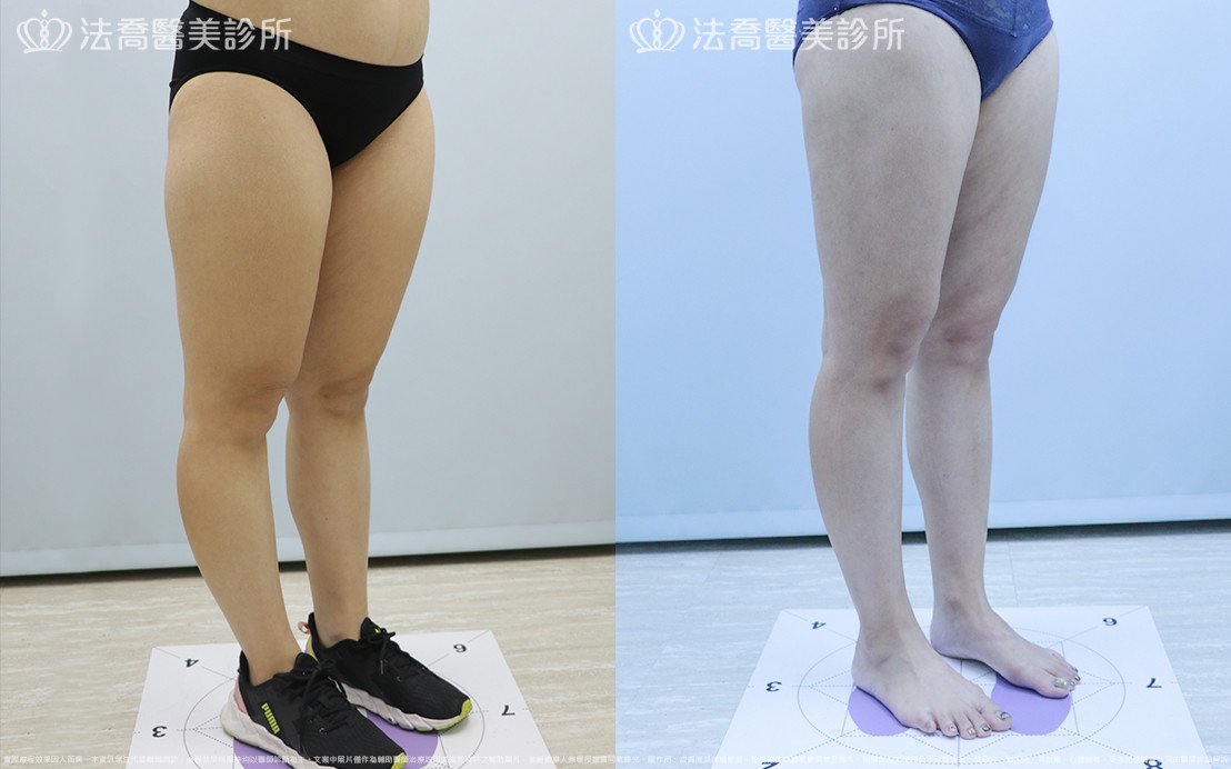 法喬醫美診所 邱浚彥醫師