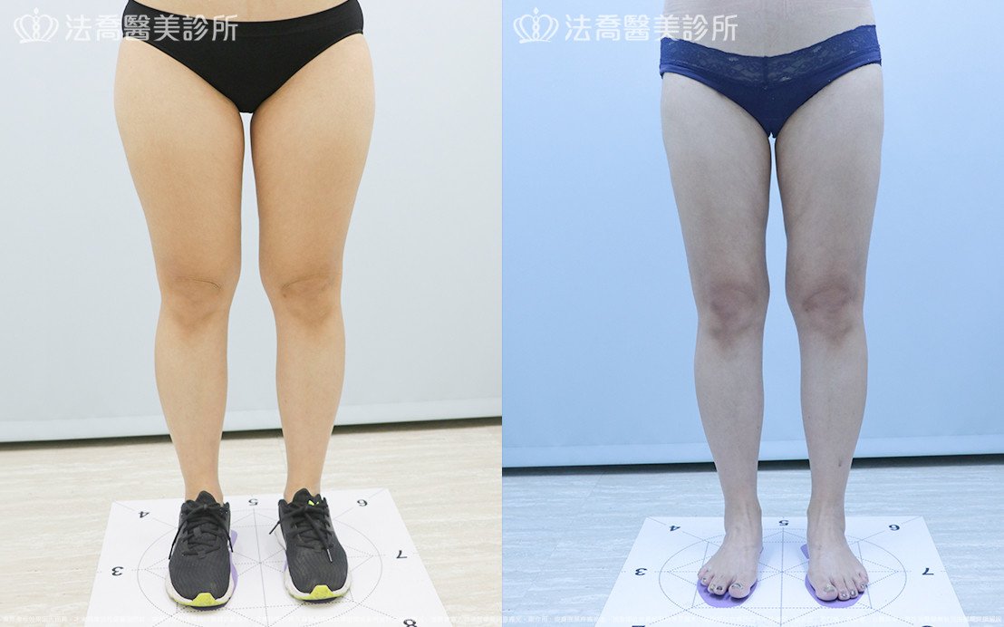 法喬醫美診所 邱浚彥醫師