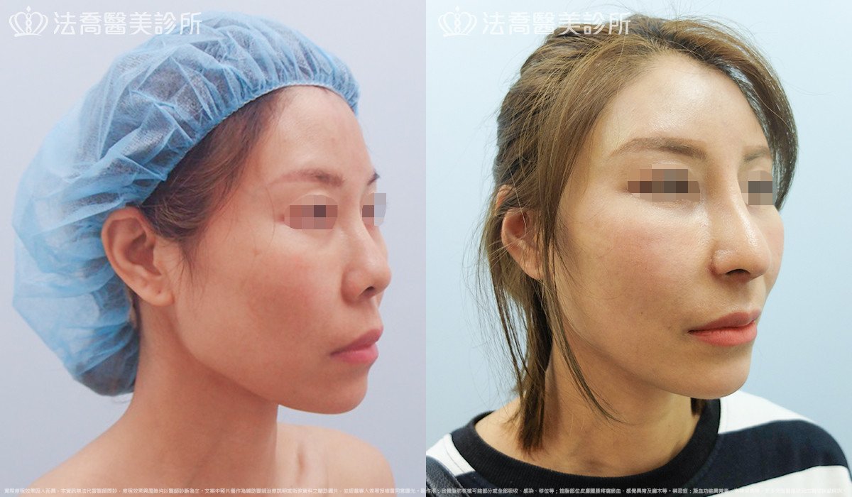 法喬醫美診所 邱浚彥醫師