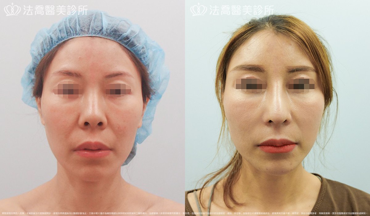 法喬醫美診所 邱浚彥醫師