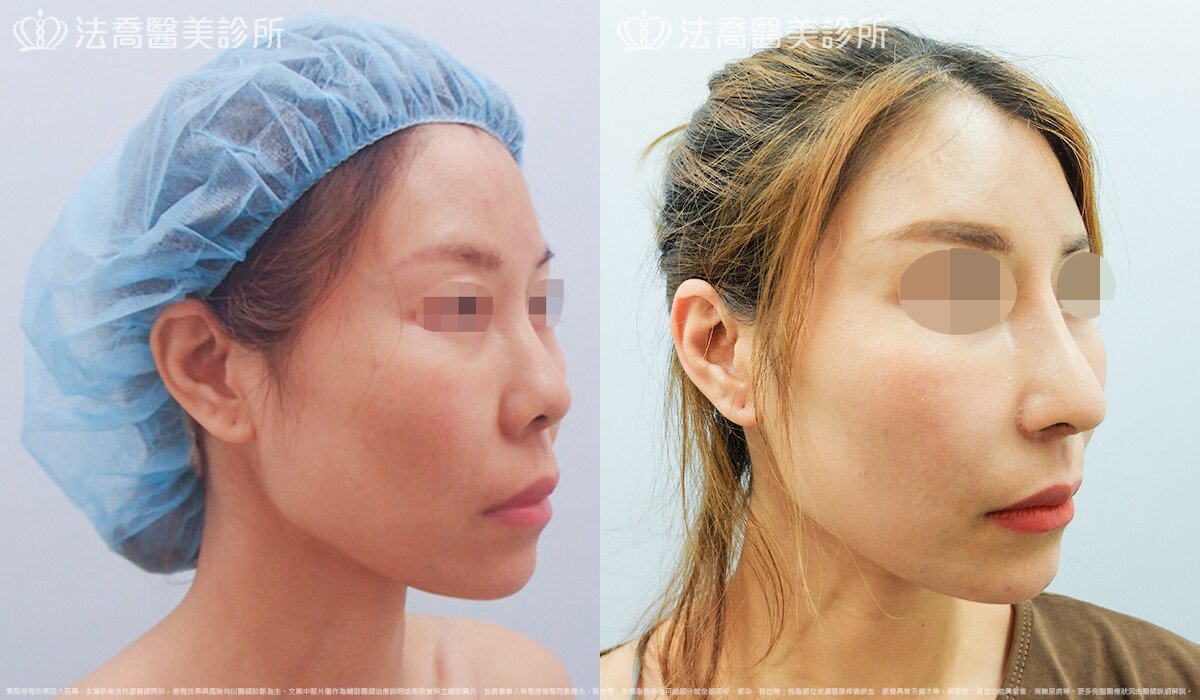 法喬醫美診所 邱浚彥醫師