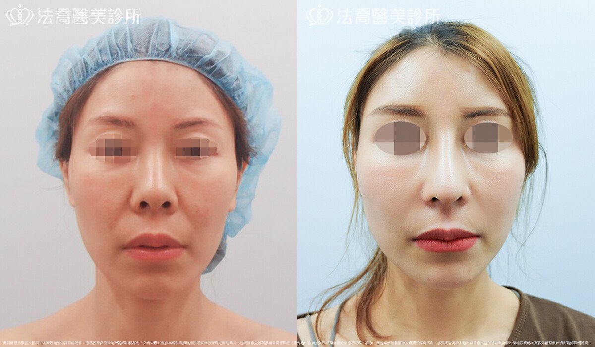 法喬醫美診所 邱浚彥醫師