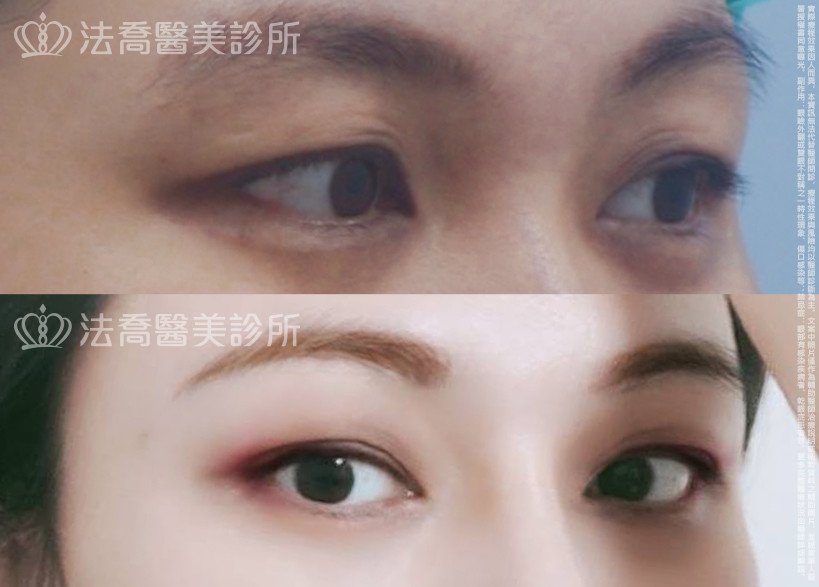 法喬醫美診所 邱浚彥醫師