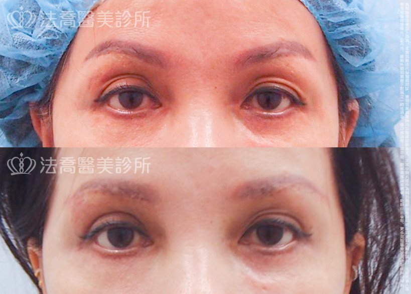 法喬醫美診所 邱浚彥醫師