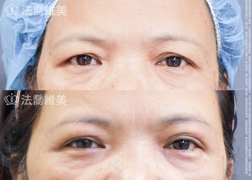 法喬維美醫美診所