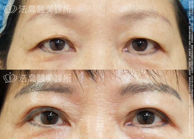 法喬醫美診所 邱浚彥醫師