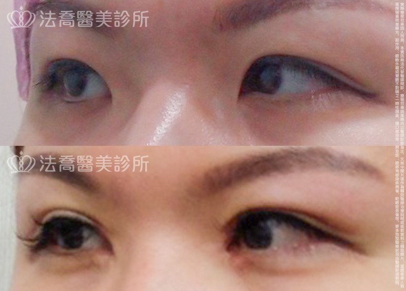 法喬醫美診所 邱浚彥醫師