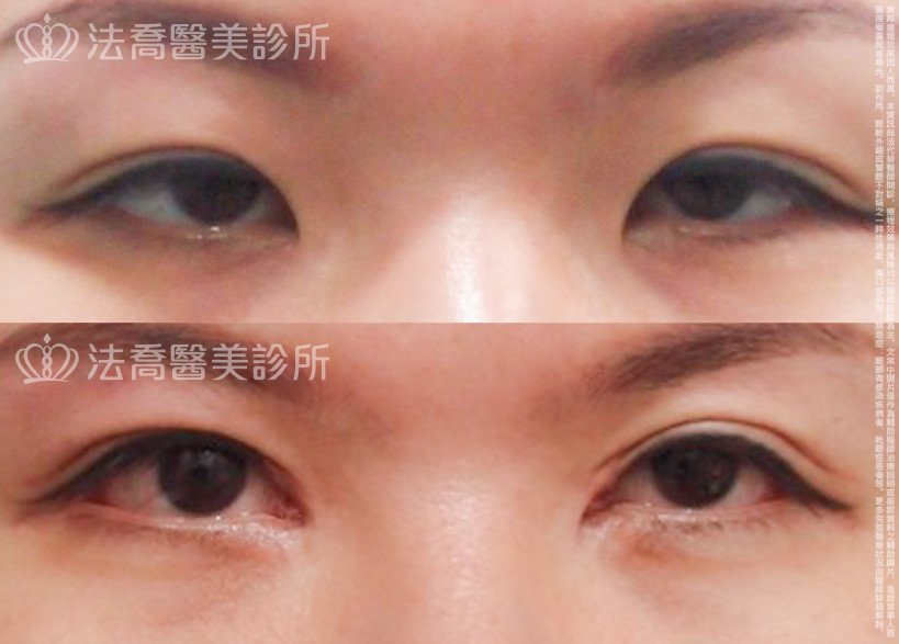 法喬醫美診所 邱浚彥醫師