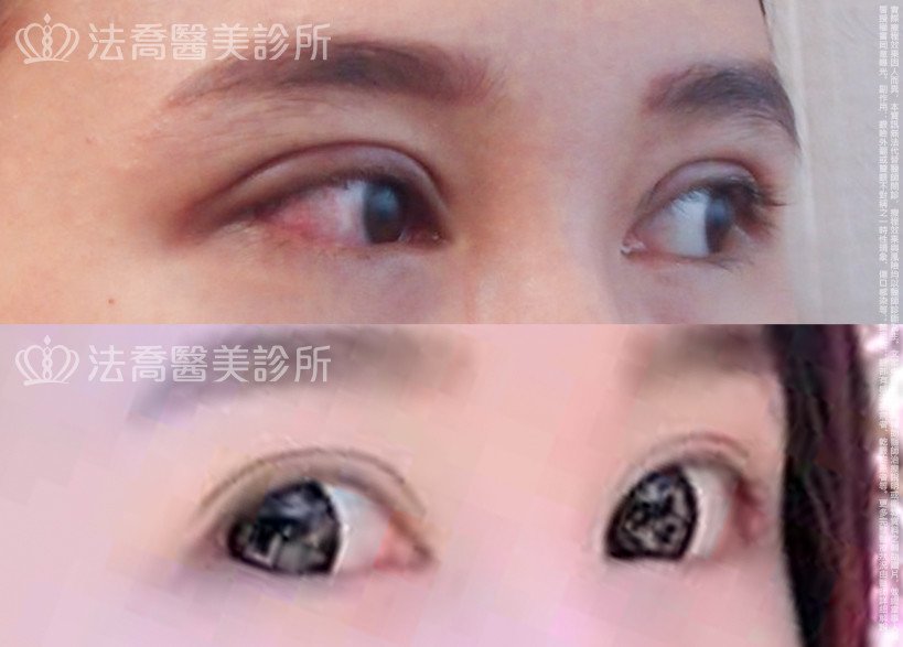 法喬醫美診所 邱浚彥醫師