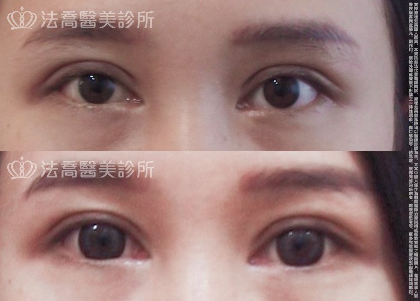 法喬醫美診所 邱浚彥醫師