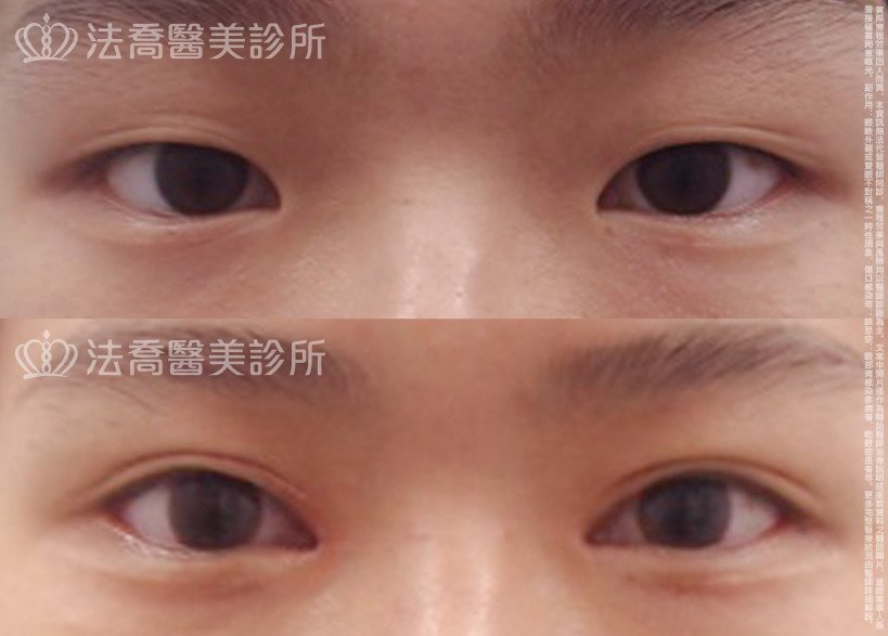 法喬醫美診所 邱浚彥醫師