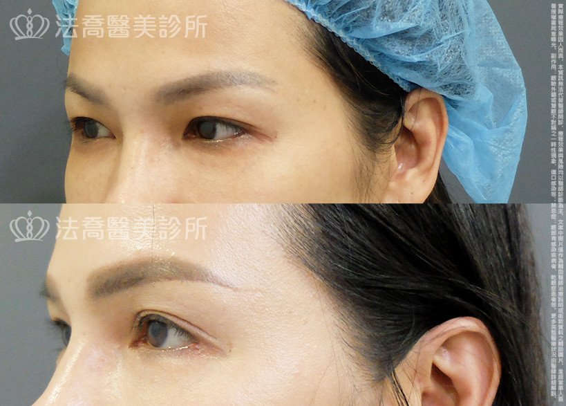 法喬醫美診所 邱浚彥醫師