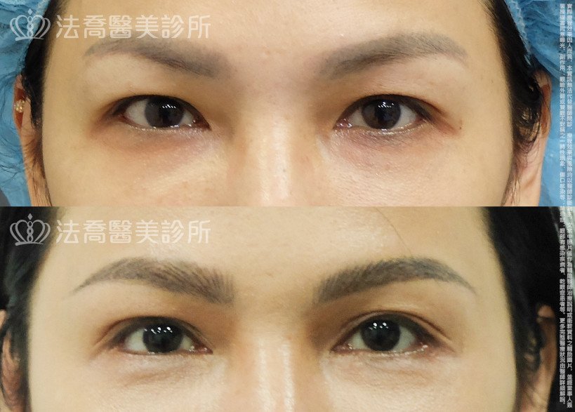 法喬醫美診所 邱浚彥醫師