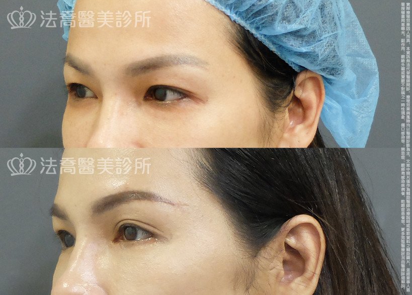 法喬醫美診所 邱浚彥醫師