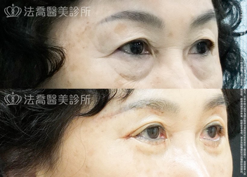 法喬醫美診所 邱浚彥醫師