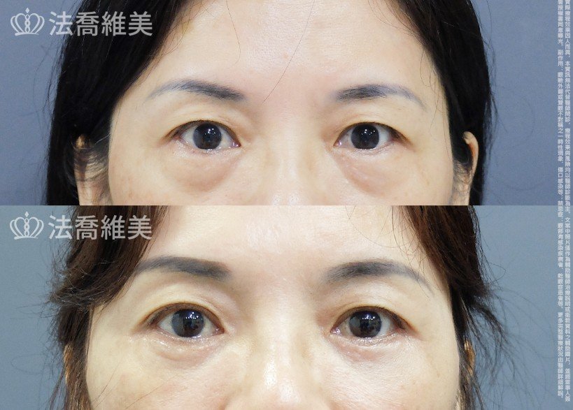 法喬維美醫美診所