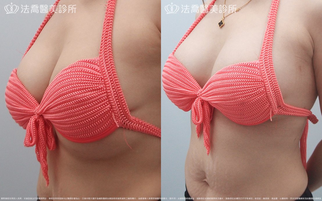 法喬醫美診所 邱浚彥醫師