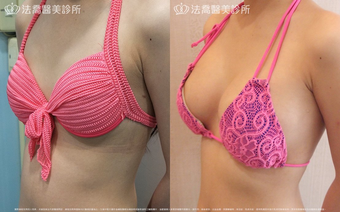 法喬醫美診所 邱浚彥醫師