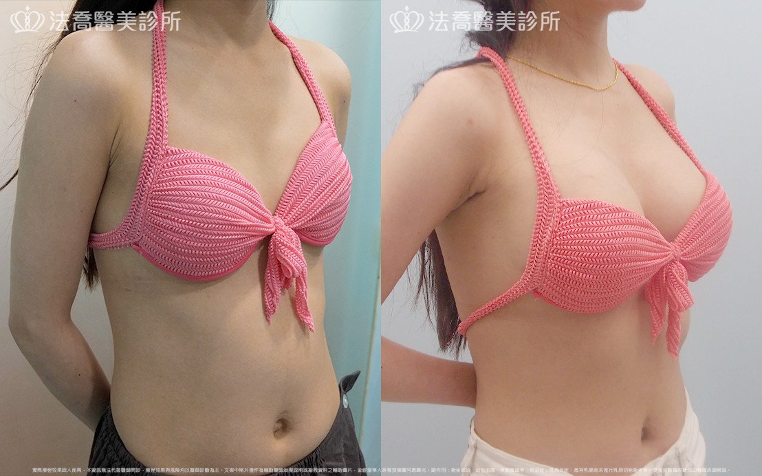 法喬醫美診所 邱浚彥醫師