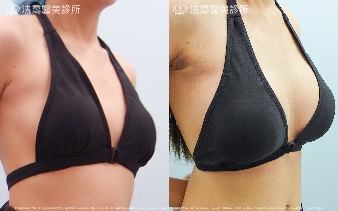 法喬醫美診所 邱浚彥醫師