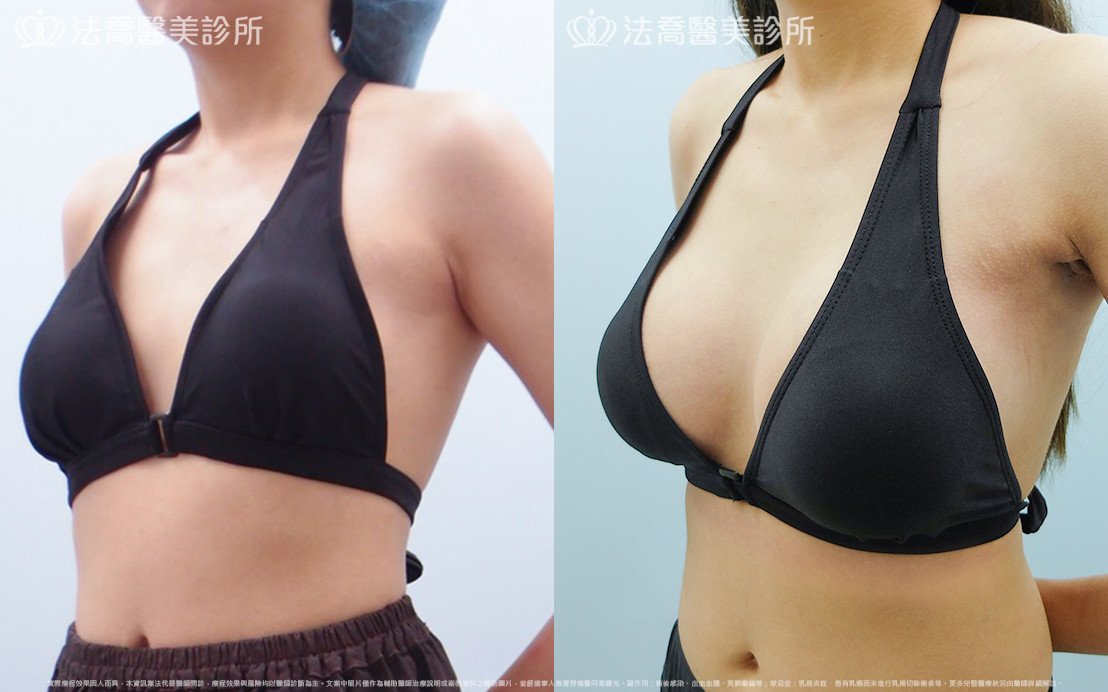 法喬醫美診所 邱浚彥醫師