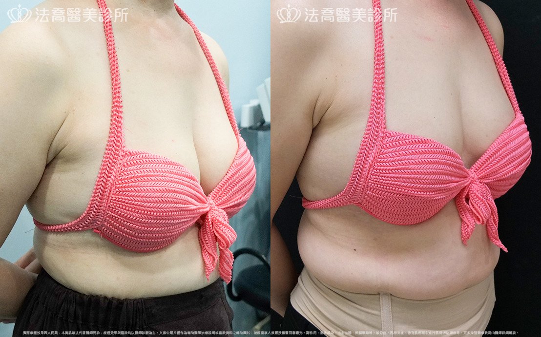 法喬醫美診所 邱浚彥醫師