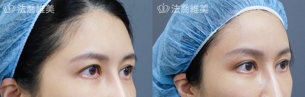沈筠惇