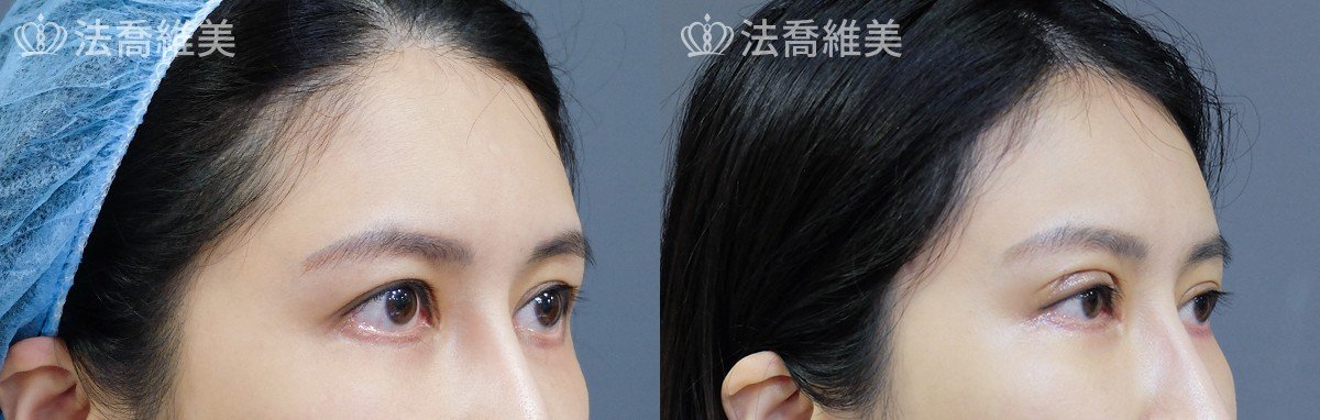 五爪拉皮