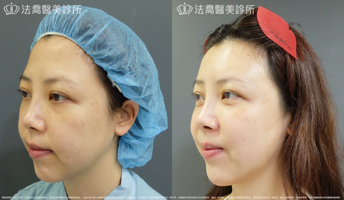 法喬醫美診所 邱浚彥醫師