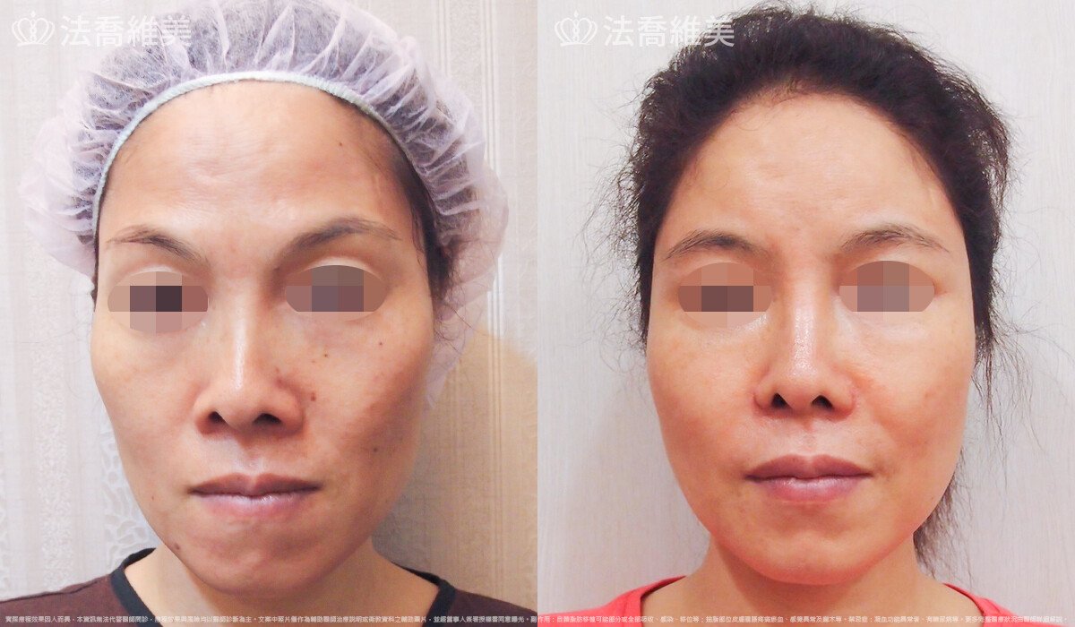 法喬醫美診所