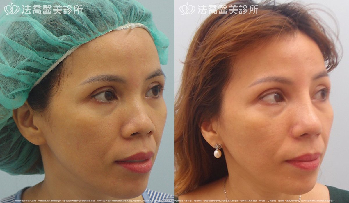 法喬醫美診所 邱浚彥醫師