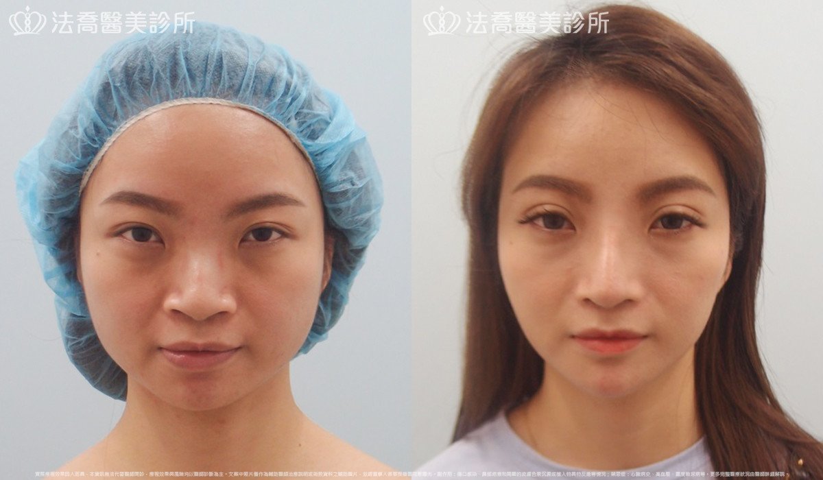 法喬醫美診所 邱浚彥醫師