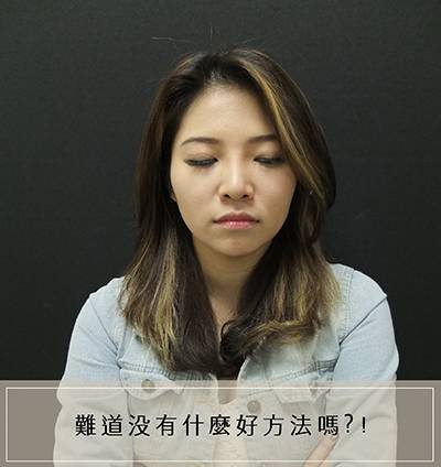 法喬醫美診所_骨水泥下巴術前