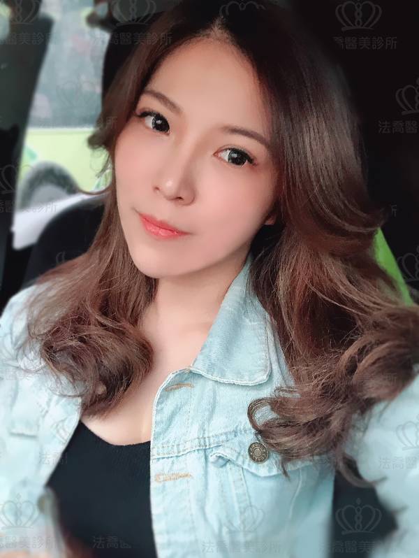 法喬醫美診所_複合式隆乳